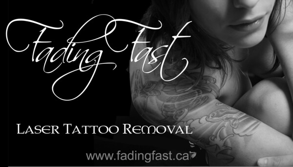 Fading Fast Laser Tattoo Removal